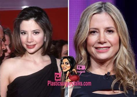 Mira Sorvino Plastic Surgery Before & After